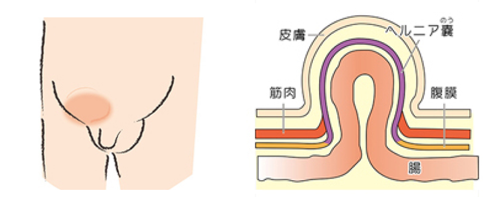 治療法画像