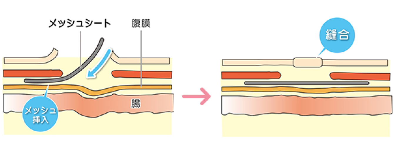 治療法画像