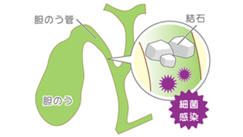 症例画像