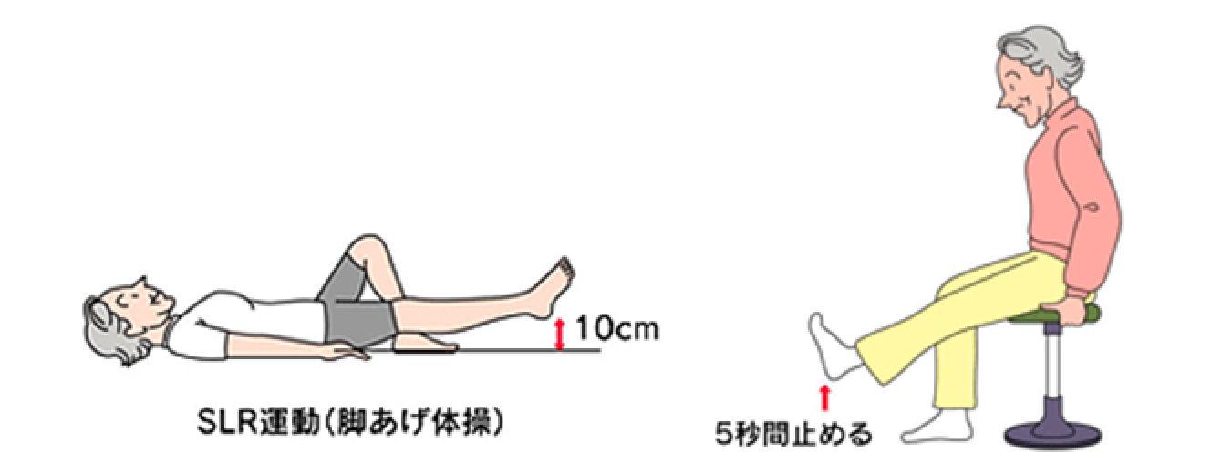 運動（リハビリ）療法のイメージ